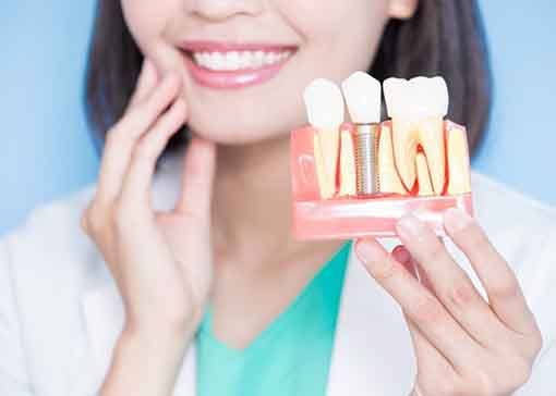 a woman holding up a model of a dental implant