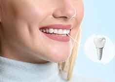 a woman smiling with new dental implants