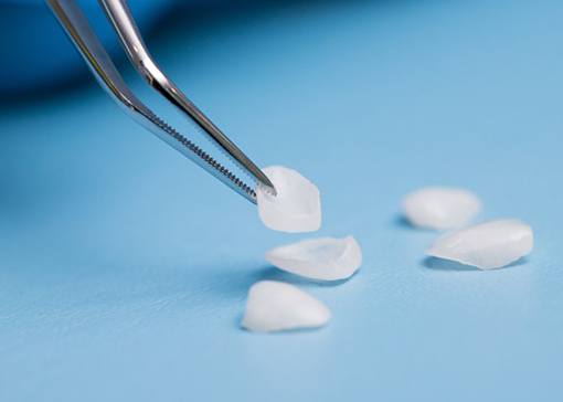 A set of dental veneers being examined in a lab