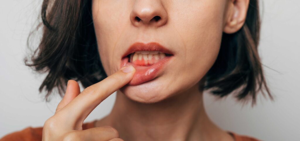 Woman with gum inflammation